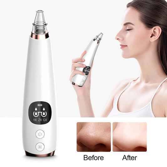 New electric blackhead removal and pore cleaning 