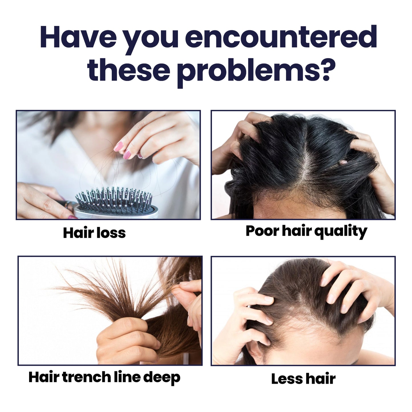 OUHOE Hair Treatment Spray Strengthens Hair, 