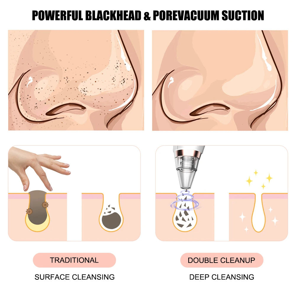 New electric blackhead removal and pore cleaning 