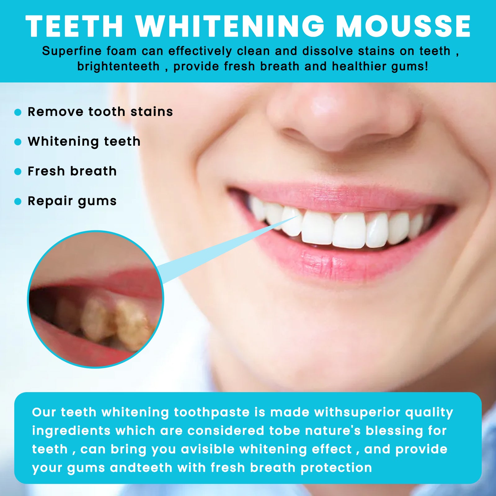 OUHOE White Teeth Mousse Clean Tartar Fresh Breath 