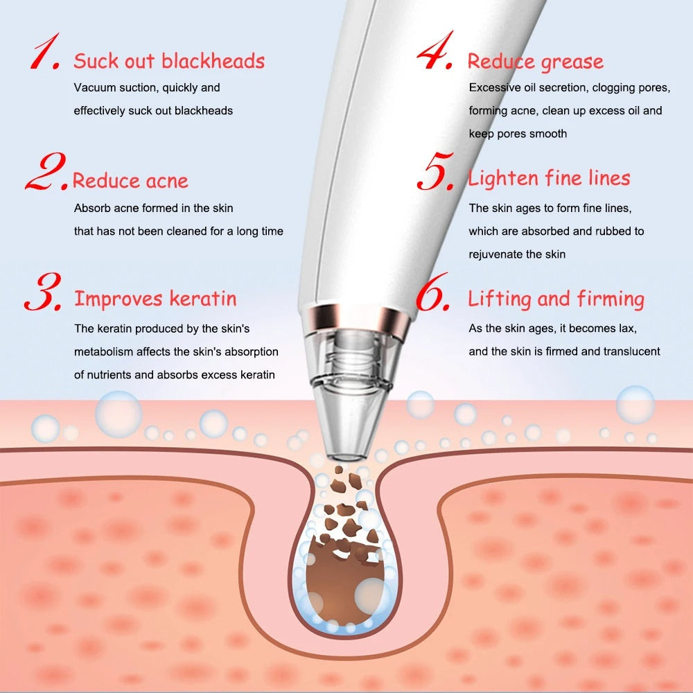 New electric blackhead removal and pore cleaning 