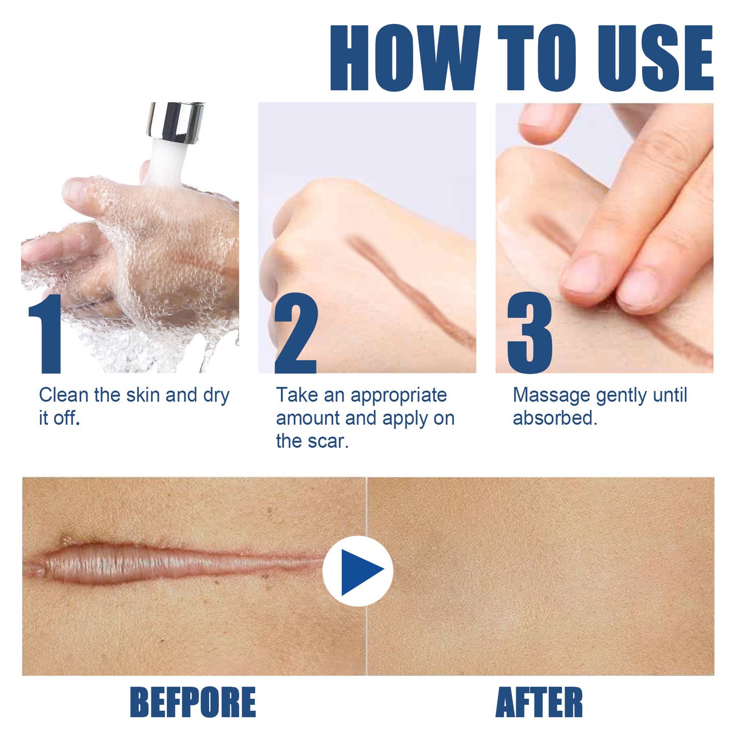 EELHOE Skin Care Cream Gentle Care External Body Care Moisturizing Smooth Skin Care Cream